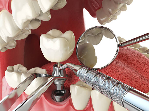 Best Emergency Root Canal Therapy in Brooklawn, NJ